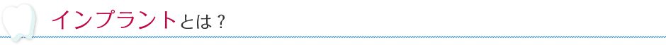 インプラントとは？