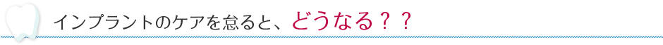 インプラントのケアを怠ると、どうなる？？